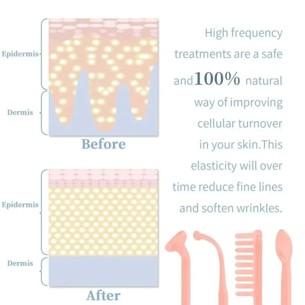 High Frequency Facial Machine Skin Therapy 4 Electrotherapy  Wands Remove Wrinkles Acne Facial Therapy Wand Portable Beauty Care